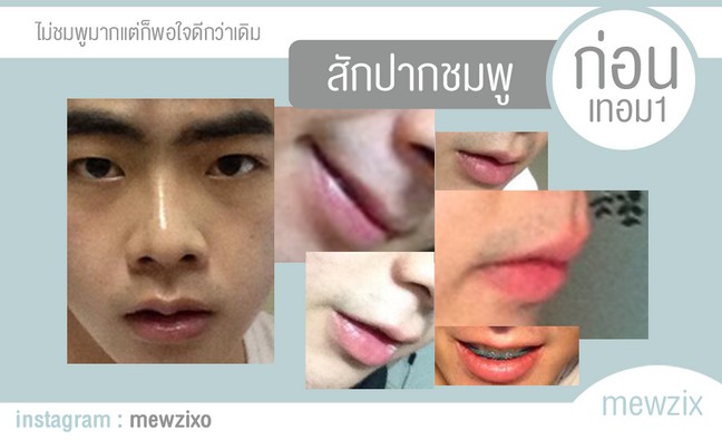 ศัลยกรรม